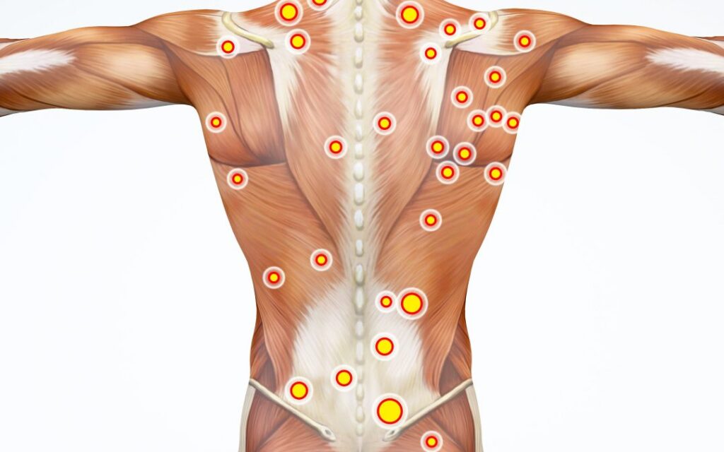 Trigger Point Massage main points